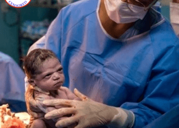 You have just been born and they already force you to wear a mask