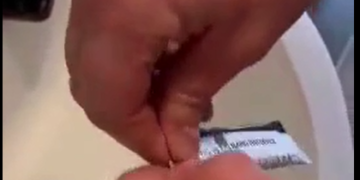 The rapid Tes of Covid 19 it’s a fraud