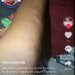Moderna Vaccine side effect