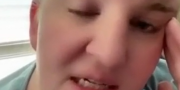 Adverse Vaccine Reaction