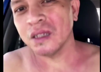 Johnson & Johnson Vaccine Adverse Reaction