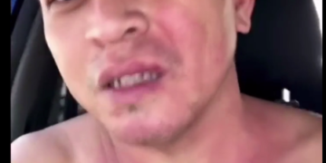 Johnson & Johnson Vaccine Adverse Reaction